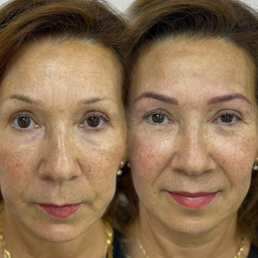 Resultado de micropigmentación de Gemma Alpuente