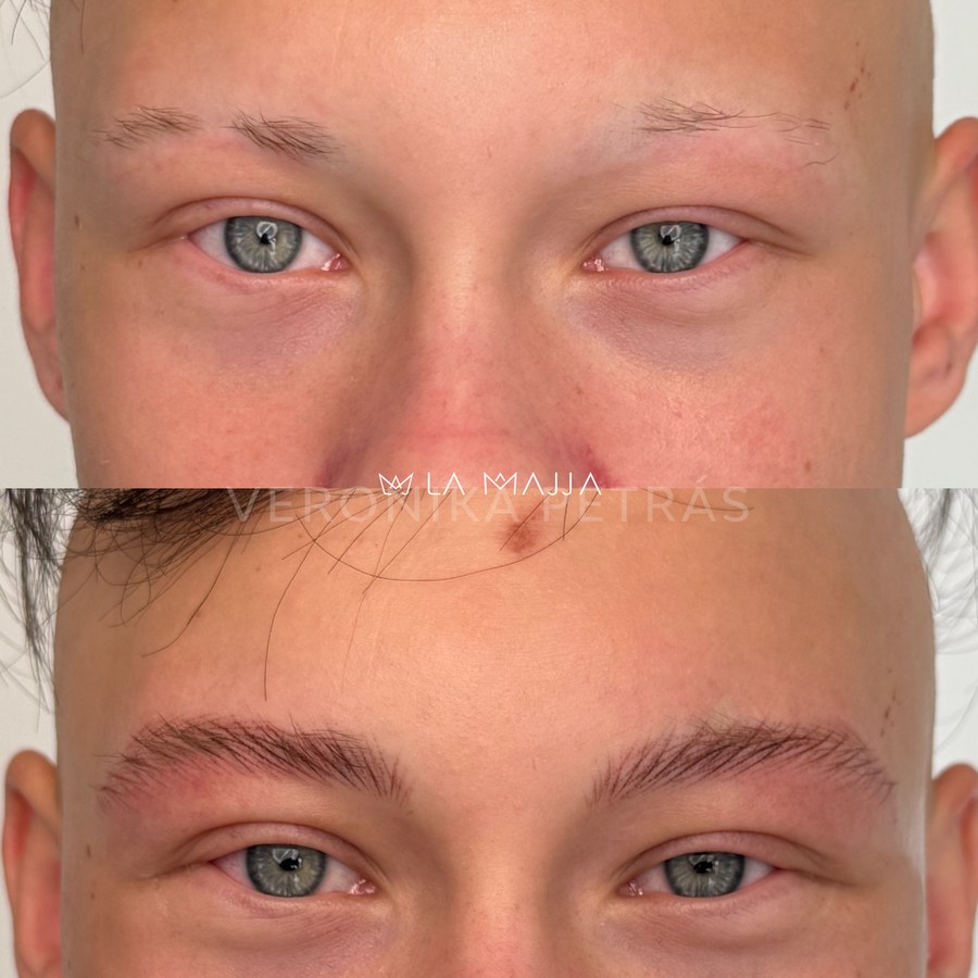 Resultado de micropigmentación de Verónika Petras